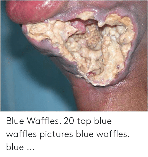 Meatball recommendet waffle blue