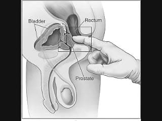 Howto massage prostate