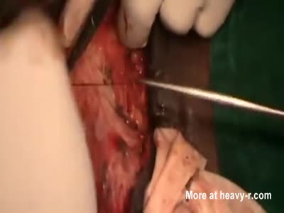 best of Testicle removal Shemale